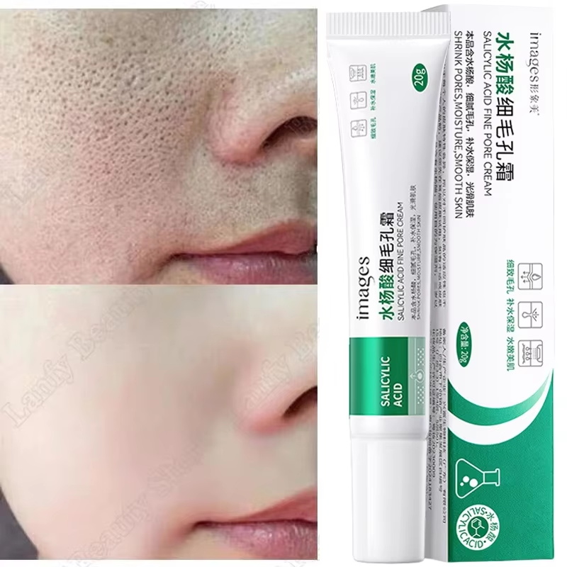 Salicylic Acid Blackhead Remover - Creme de Ácido Salicílico para Limpeza